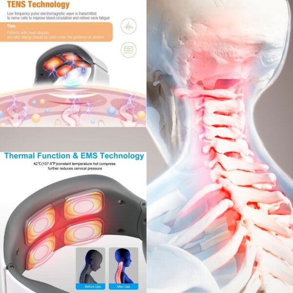 Masajeador Cuello Cervical, Masajeador Eléctrico Portátil con Terapia Calor - Imagen 3